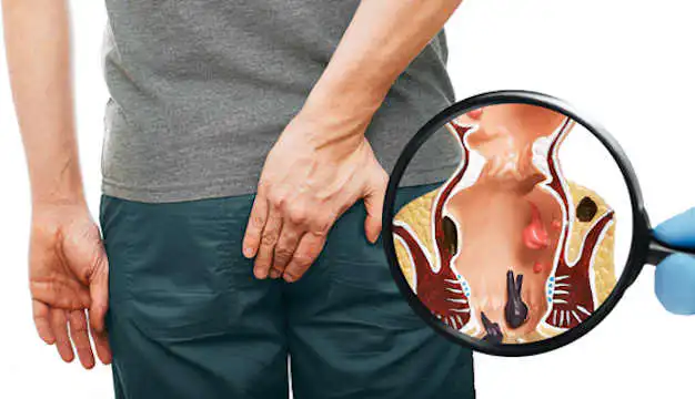 Proctologist's,Hand,With,A,Magnifying,Glass,Shows,The,Pathology,Of