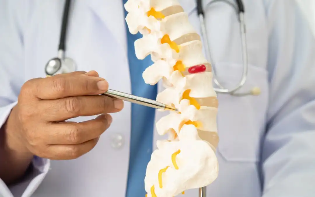 Do Hernias Go Away Without Surgery? Facts You Should Know