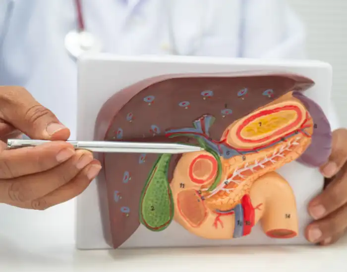 Problems After Gallbladder Removal Years Later: Symptoms & Treatment