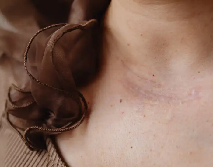 Skin Cancer Symptoms: Early Warning Signs You Should Not Ignore