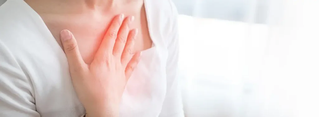 Acid Reflux